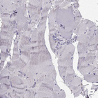 Immunohistochemical staining of human skeletal muscle shows no positivity in myocytes as expected.