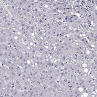 Immunohistochemical staining of human liver shows no positivity in hepatocytes as expected.