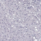 Immunohistochemical staining of human liver shows no positivity in hepatocytes as expected.