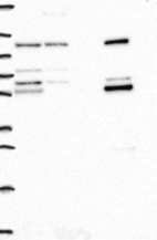 Lane 1: Marker [kDa] 250, 130, 95, 72, 55, 36, 28, 17, 10 | Lane 2: RT4 | Lane 3: U-251 MG | Lane 4: Human Plasma | Lane 5: Liver | Lane 6: Tonsil