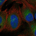 Anti-ZNF208 Antibody