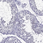Immunohistochemical staining of human testis shows high expression.