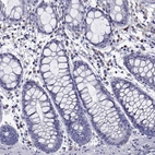 Immunohistochemical staining of human rectum shows low expression as expected.