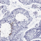 Immunohistochemical staining of human testis shows high expression.