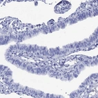 Immunohistochemical staining of human fallopian tube shows low expression as expected.