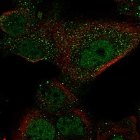 Anti-GAL3ST1 Antibody