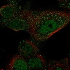 Anti-GAL3ST1 Antibody