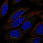 Anti-TMEM168 Antibody