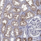 Anti-SLC34A1 Antibody