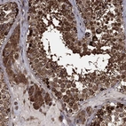 Anti-CYLD Antibody