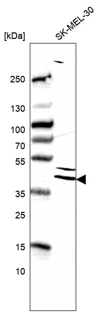 Anti-DUSP4 Antibody