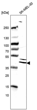 Anti-DUSP4 Antibody