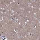 Anti-LY6H Antibody