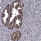 Anti-GPAA1 Antibody