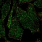 Anti-PLEKHH2 Antibody