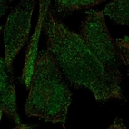 Anti-PLEKHH2 Antibody