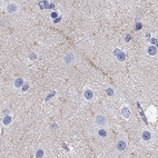 Anti-CACNG3 Antibody