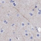 Immunohistochemical staining of human cerebral cortex shows high expression.