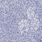 Anti-CACNG3 Antibody