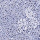 Immunohistochemical staining of human pancreas shows low expression as expected.