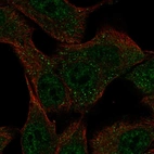 Anti-SLC43A3 Antibody