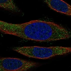 Immunofluorescent staining of human cell line SiHa shows localization to cytosol.