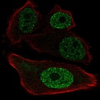 Anti-ETV1 Antibody