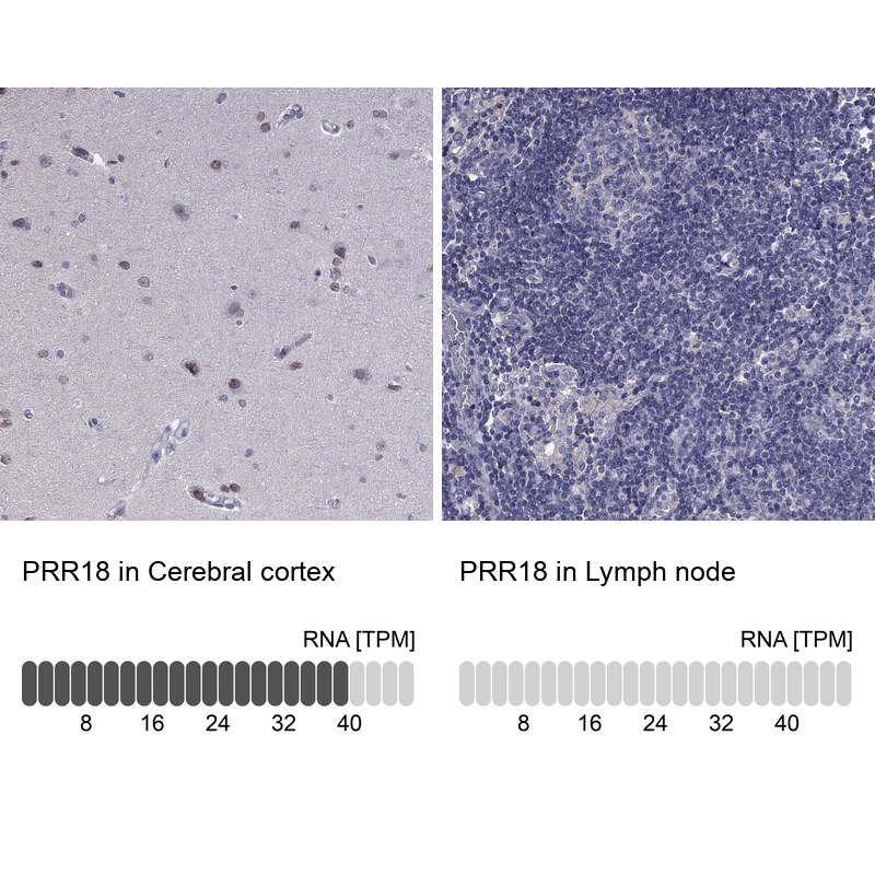 Anti-PRR18 Antibody