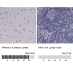 Anti-PRR18 Antibody