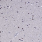 Immunohistochemical staining of human cerebral cortex shows high expression.