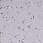 Immunohistochemical staining of human cerebral cortex shows high expression.