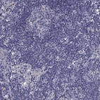 Anti-PRR18 Antibody