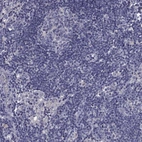 Immunohistochemical staining of human lymph node shows low expression as expected.