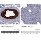 Anti-MTHFR Antibody
