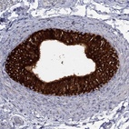 Immunohistochemical staining of human epididymis shows high expression.