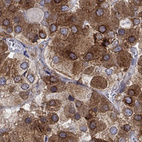 Immunohistochemical staining of human pituitary gland shows strong positivity in cells in anterior.
