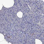 Immunohistochemical staining of human pancreas shows low expression as expected.