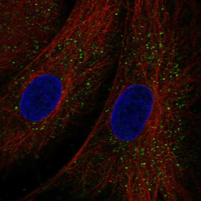 Anti-TEX36 Antibody