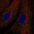 Anti-TEX36 Antibody