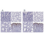 Immunohistochemical staining of human duodenum, kidney, prostate and skin using Anti-LOR antibody HPA077266 (A) shows similar protein distribution across tissues to independent antibody HPA076123 (B).