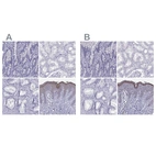 Immunohistochemical staining of human duodenum, kidney, prostate and skin using Anti-LOR antibody HPA077266 (A) shows similar protein distribution across tissues to independent antibody HPA076123 (B).