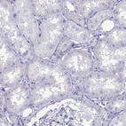 Immunohistochemical staining of human kidney shows no positivity in exocrine glandular cells as expected.
