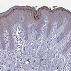 Immunohistochemical staining of human skin shows moderate to strong positivity in epidermal cells.