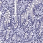 Immunohistochemical staining of human duodenum shows no positivity in glandular cells as expected.