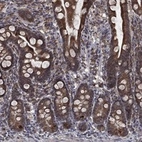 Anti-ESRRA Antibody