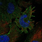 Anti-PCDHGC3 Antibody