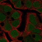 Anti-TFDP3 Antibody