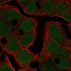 Anti-TFDP3 Antibody