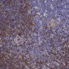 Immunohistochemical staining of human lymph node shows high expression.