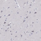 Immunohistochemical staining of human cerebral cortex shows low expression as expected.